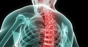 Spondiloartriti, convegno teorico-pratico sabato 23 marzo a Rende