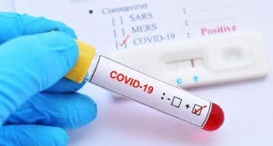 La Calabria è zona rossa, non solo per il Coronavirus