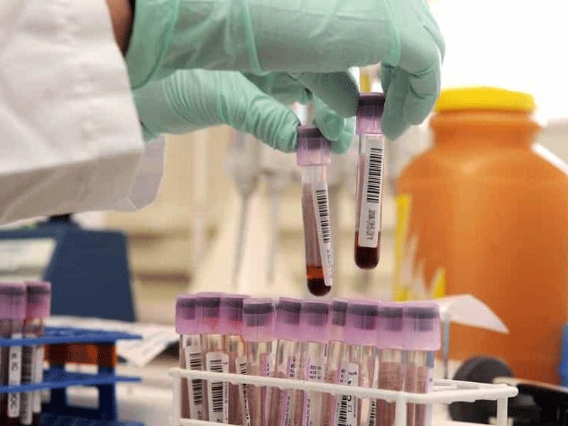 Covid la Regione aderisce al progetto europeo per la raccolta del plasma