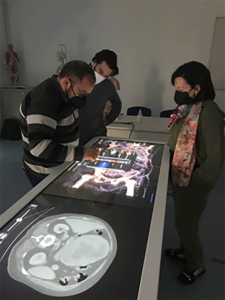 I tutors Rocco Malivindi, Francesca Giordano e Daniele Paglione del corso di simulazione preoperatoria di pazienti con tumori tramite ricostruzione 3D al tavolo anatomico