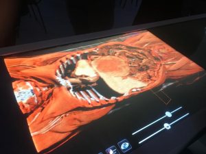 Un viaggio della Salute all’ospedale dell’Annunziata di Cosenza