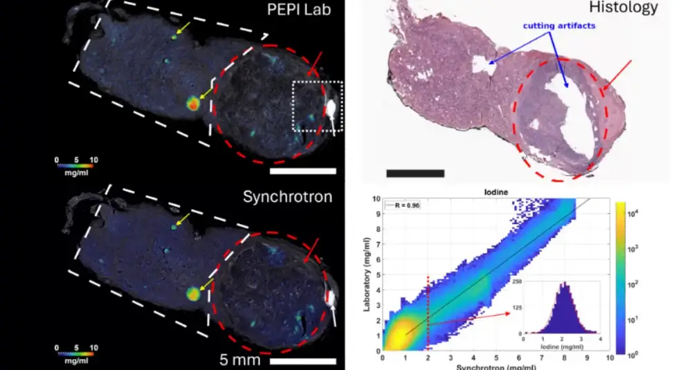 Istologia virtuale e tumori, la ricerca con il contributo dell’UniCal rivoluziona lo studio della tiroide